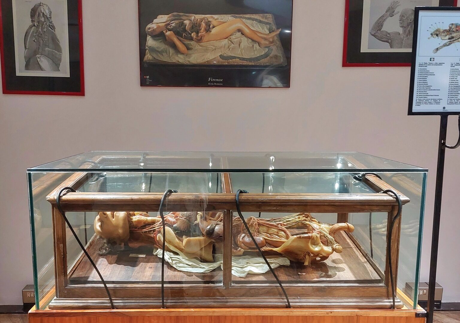 Cagliari: riapre il Museo delle cere anatomiche | Cagliari - Vistanet