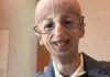 Muore Sammy Basso, fatale un malore in ristorante: il 28enne era malato di progeria